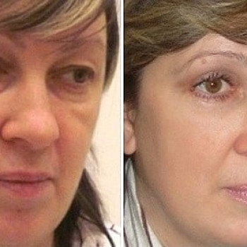 Елена Плотникова, Київ Фото - 11