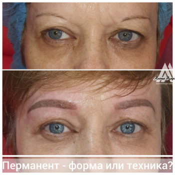 Татуаж губ от акварельного до закраса
                    Косметолог Алена Харьков