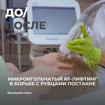 Beautymed Clinic, Запоріжжя Фото - 38