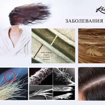 Диагностика трихоскопом
                    Тритментолог Юлия Полтава