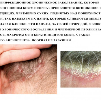 Диагностика трихоскопом
                    Тритментолог Юлия Полтава