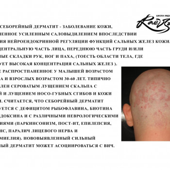 Диагностика трихоскопом
                    Тритментолог Юлия Полтава