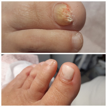 PODOSTEP, Київ Фото - 18