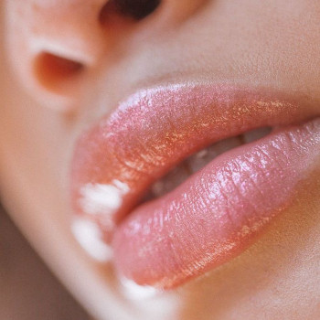 Венеция, Житомир Фото - 10