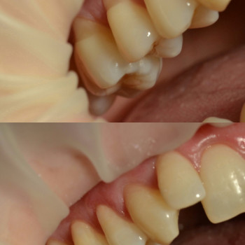 Аліна Степанюк, Рівне Фото - 10