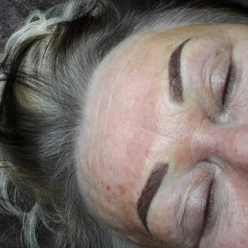 Ичправление ассиметрии