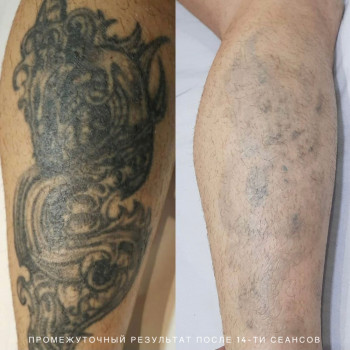 B.L.C, Київ Фото - 33