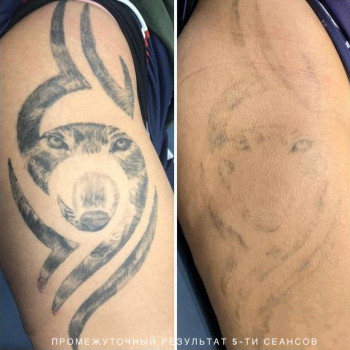 B.L.C, Київ Фото - 64