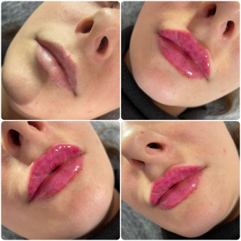 Анастасия Полупенко, Бердянськ Фото - 13