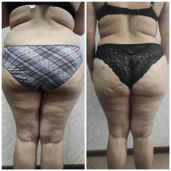 Яна Скорик, Мелітополь Фото - 5