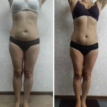 Яна Скорик, Мелітополь Фото - 6