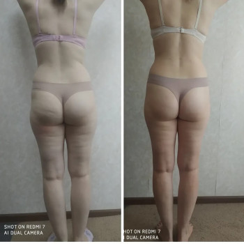 Яна Скорик, Мелітополь Фото - 8