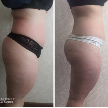 Яна Скорик, Мелітополь Фото - 10