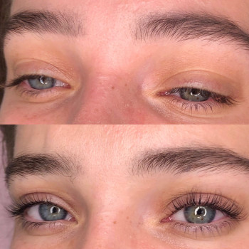 ЛАМІНУВАННЯ ВІЙ