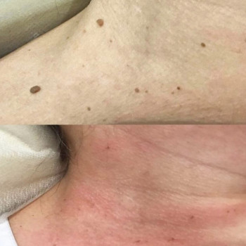 Юлия Ляшенко, Київ Фото - 8