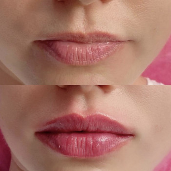 Юлия Ляшенко, Київ Фото - 17