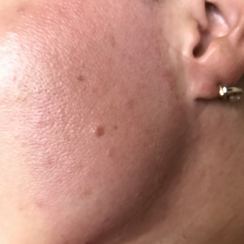 Ваксинг
                    Майстер депіляції Ольга Агаджанова Одеса