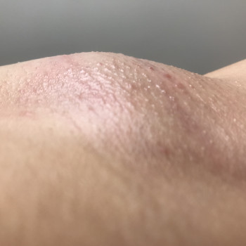 Ваксинг
                    Майстер депіляції Ольга Агаджанова Одеса