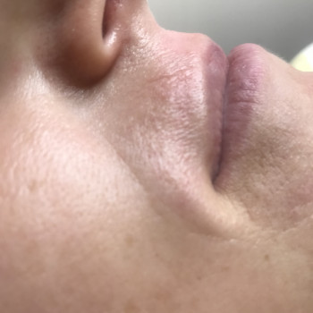 Ваксинг
                    Майстер депіляції Ольга Агаджанова Одеса