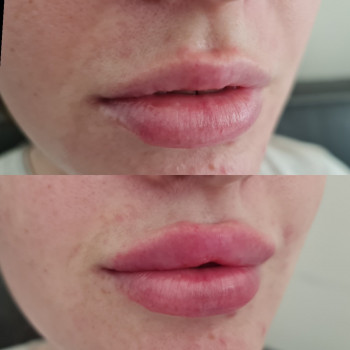 Ірина Литвінова, Херсон Фото - 62