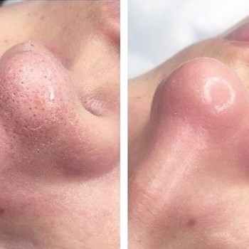 После глубокой чистки!)