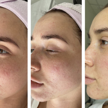 Элина Липовая, Днепр Фото - 7