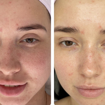 Элина Липовая, Днепр Фото - 8