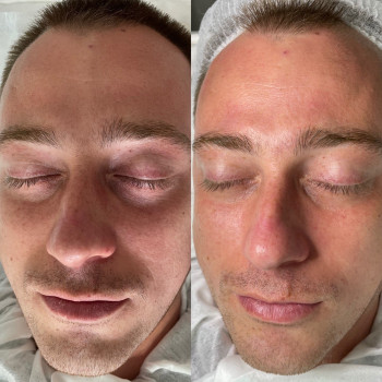 Элина Липовая, Днепр Фото - 9