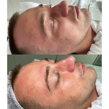 Элина Липовая, Днепр Фото - 10