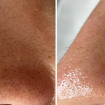 Элина Липовая, Днепр Фото - 11