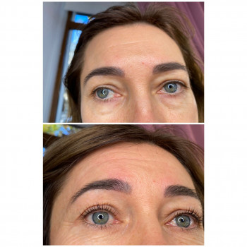 Ламинирование ресниц + окрашивание + ботокс
                    Бровист Зоя Одесса