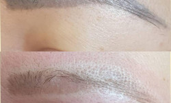 Удаление ПМ ремувером Мастер перманентного макияжа Алина Павлоград