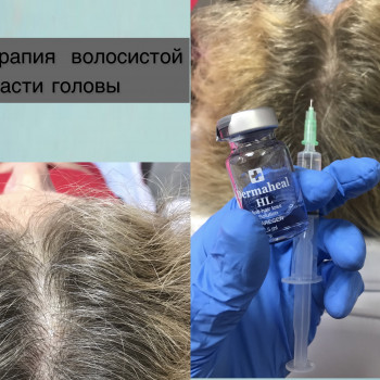 Марина Копыл, Днепр Фото - 28