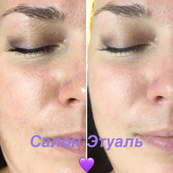 Этуаль, Одесса Фото - 43