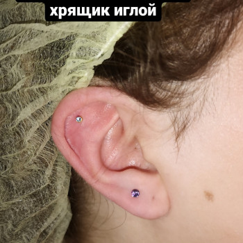 Прокол ушей (есть 4 разные системы) Inverness, XXL, Studex 75, Caflon
                    Косметолог-ін'єкціоніст Наталия Одеса