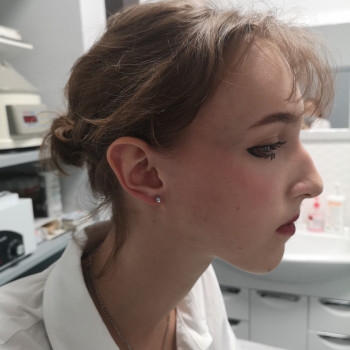 Прокол ушей (есть 4 разные системы) Inverness, XXL, Studex 75, Caflon
                    Косметолог-ін'єкціоніст Наталия Одеса