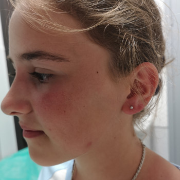 Прокол ушей (есть 4 разные системы) Inverness, XXL, Studex 75, Caflon
                    Косметолог-ін'єкціоніст Наталия Одеса