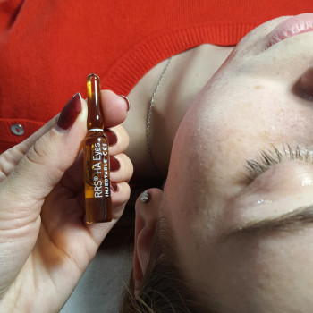 Мезотерапія