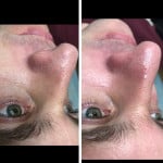 -20% знижка від повної ціни!!! Лікар-косметолог Христина Тернопіль