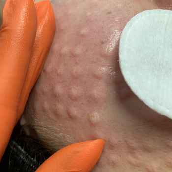 Наталія COSMO beauty, Тернопіль Фото - 17