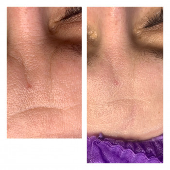 Зинаида Шуллер, Ужгород Фото - 12