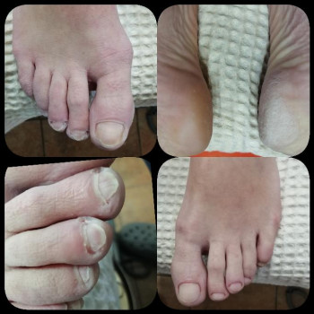 Педикюр с обработкой стопы.