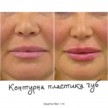 Ліна Гетьман, Тернополь Фото - 19