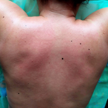 Татьяна Дрозда, Запоріжжя Фото - 10