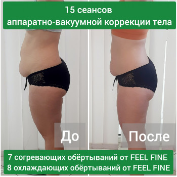 Апаратно-вакуумна корекція тіла
                    Масажист Татьяна Запоріжжя