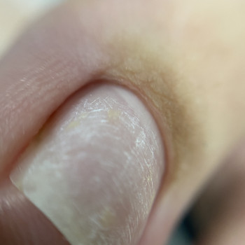 Комплексный педикюр (сложные стопы)
                    Мастер маникюра Виктория Одесса