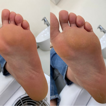 Комплексный педикюр (сложные стопы)
                    Мастер маникюра Виктория Одесса