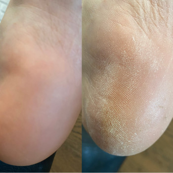 Комплексный педикюр (сложные стопы)
                    Мастер маникюра Виктория Одесса