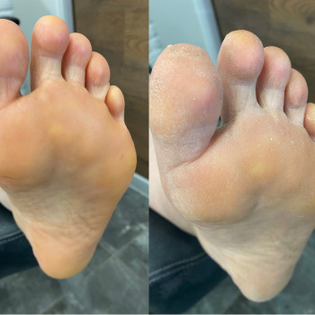 Комплексный педикюр (сложные стопы)
                    Мастер маникюра Виктория Одесса