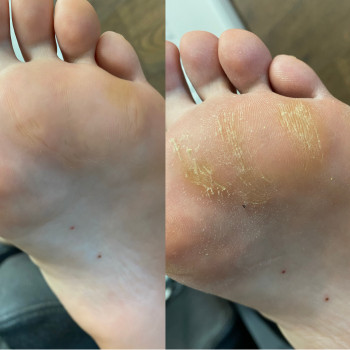 Комплексный педикюр (сложные стопы)
                    Мастер маникюра Виктория Одесса